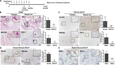 Adipose-Derived Stem Cells Promote Bone Coupling in Bisphosphonate-Related Osteonecrosis of the Jaw by TGF-β1